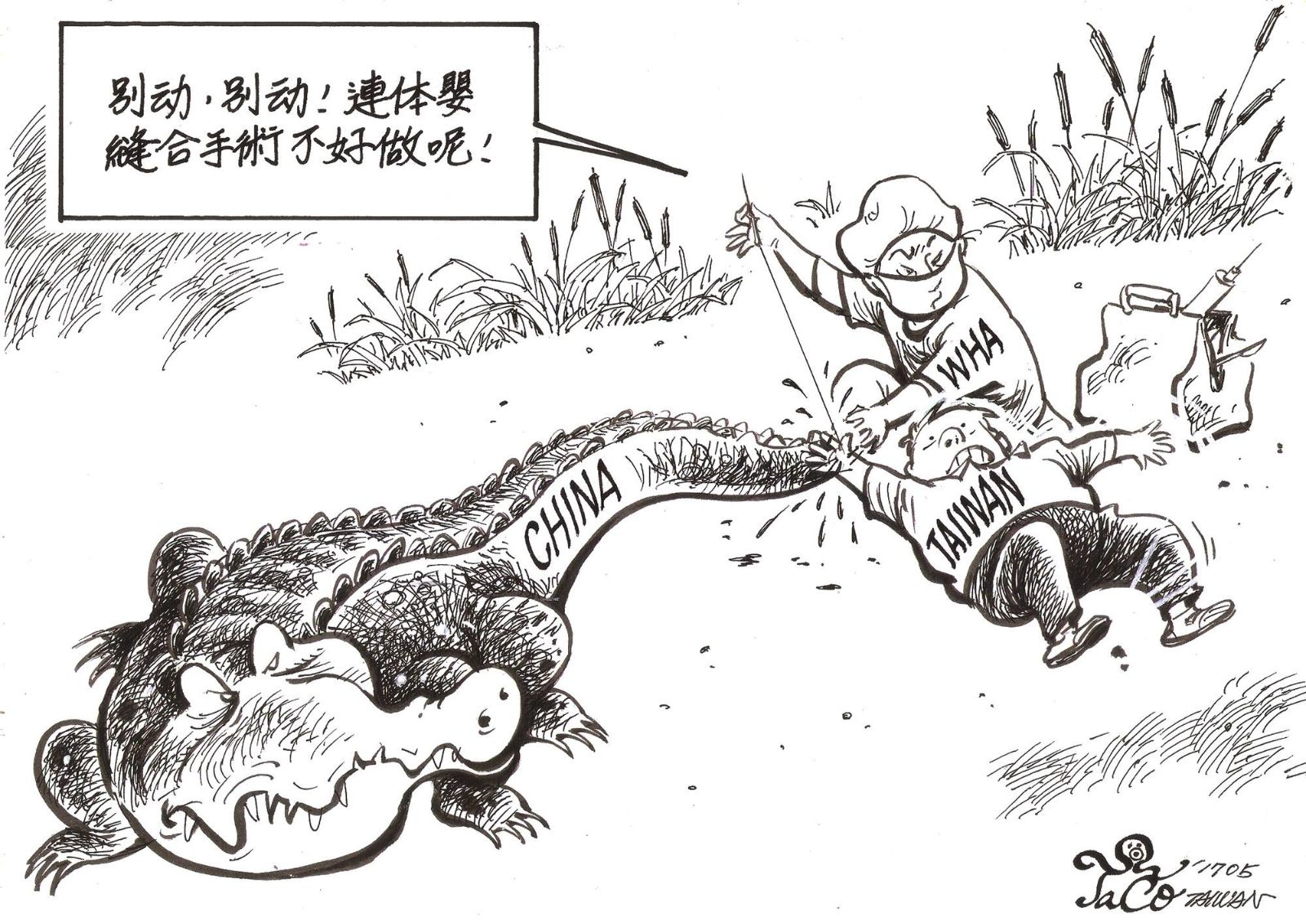 連體嬰縫合手術